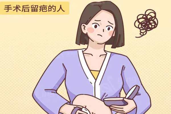 手术疤痕