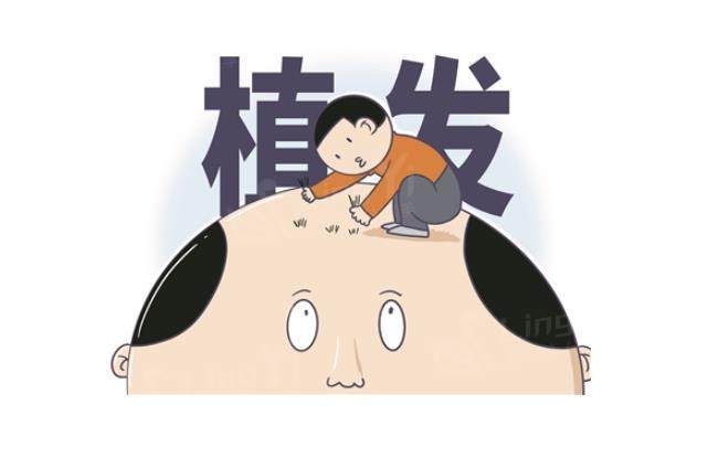 重庆植发哪家好靠谱