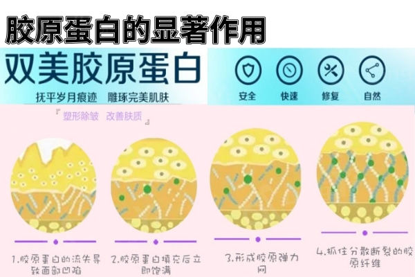 胶原蛋白填充泪沟的优点