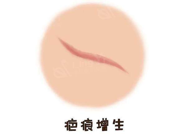 北京康疤医院祛疤痕怎么样