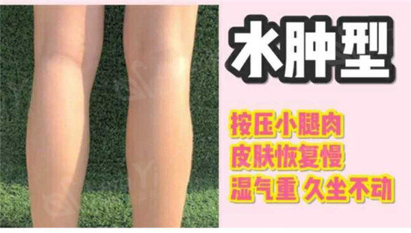 小腿水肿是什么原因造成的？小腿浮肿怎么消除呢？