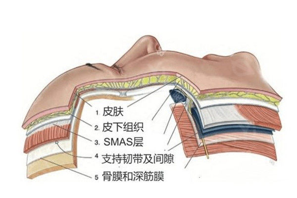 泰国曼谷整形医院 