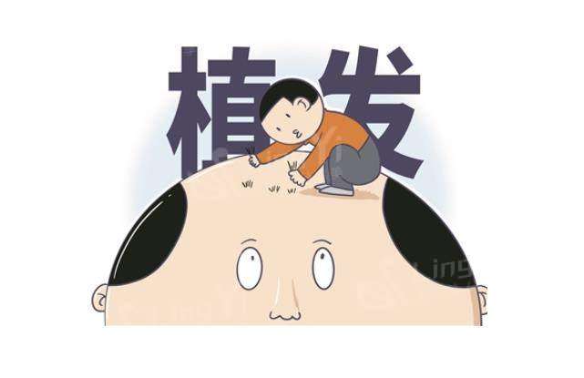 银川首欣植发哪个医生好