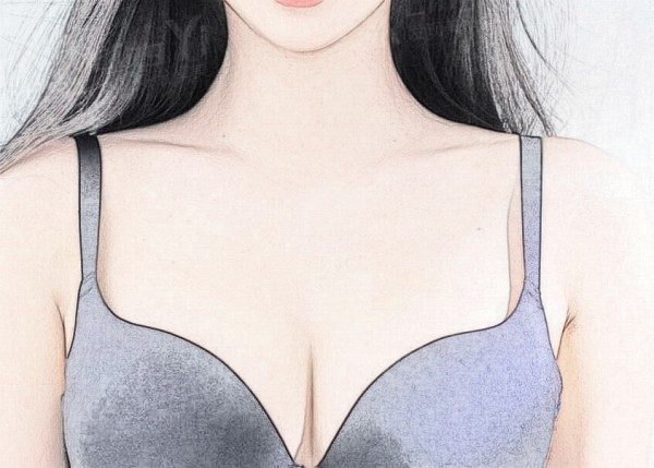 隆胸