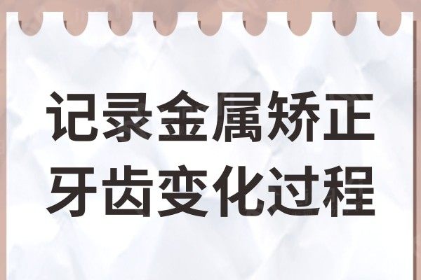 从自卑到自信，记录金属牙齿矫正变化的惊人过程