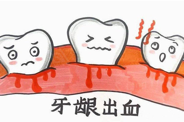 刷牙出血是不是口腔发出求救信号？牙龈出血的原因及护理方法给大家