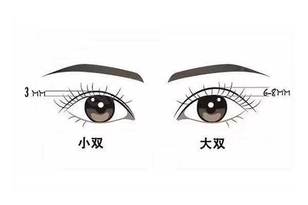 韩国世美整形眼修复为什么出名？看病例/院长技术就知道