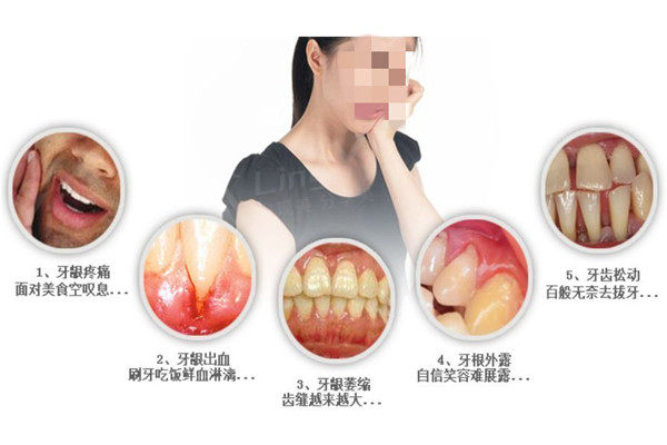 牙龈萎缩牙根外露