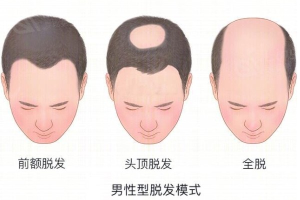 碧莲盛植发可靠吗