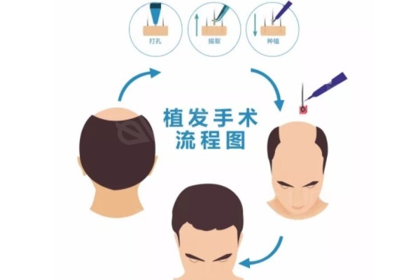 曙光植发医院是正规的吗？