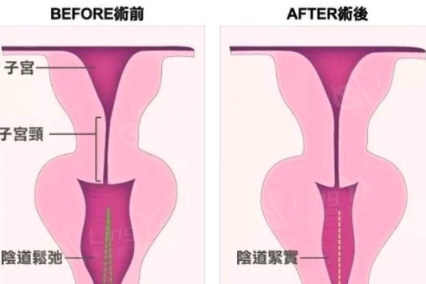  武汉私密整形哪家医院好？