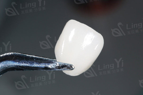 青岛牙齿贴面口碑榜top10大型齿科医院：青岛诺德口腔/可恩放心选择不踩雷