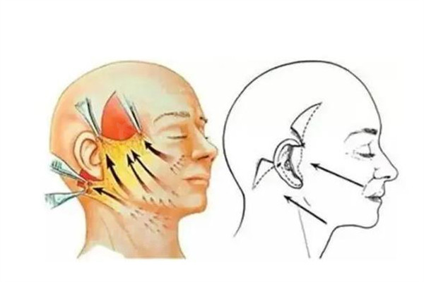 深圳拉皮手术医院排名前十