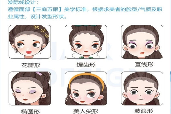 发际线植发