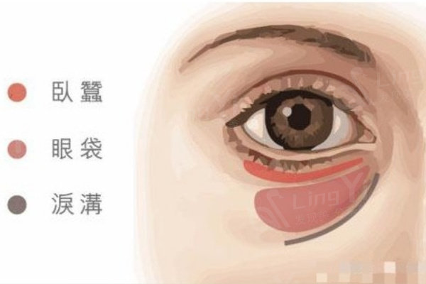 眼 (11).jpg