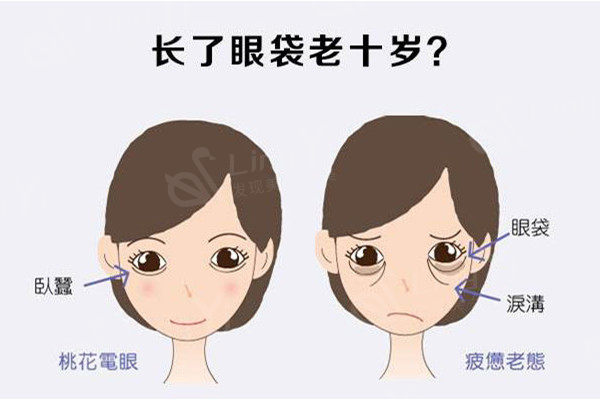 去眼袋