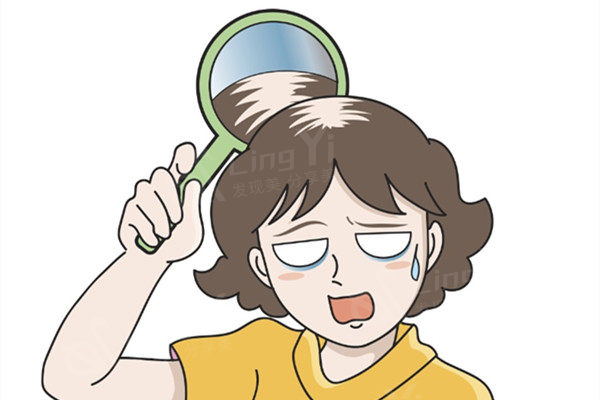 植发