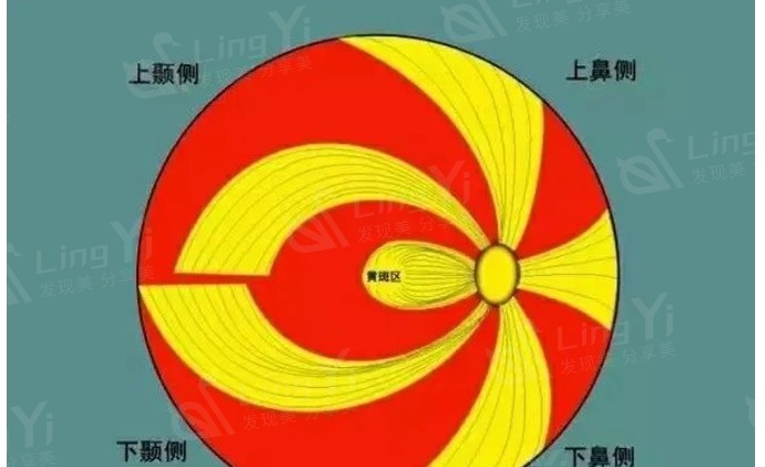 白内障手术晶体怎么选择?白内障人工晶体进口和国产的区别曝光