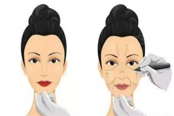广元整形医院哪家好?排名前十的美华/朗睿/达芬奇医美性价比高口碑好