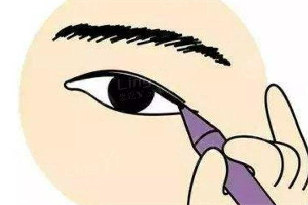 修复双眼皮