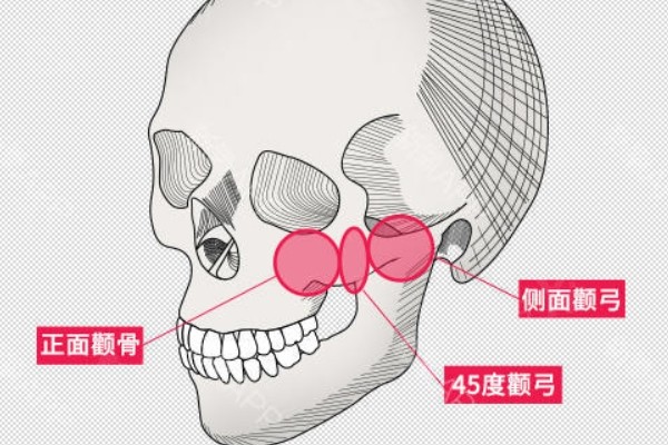 更新北京整形医院排名前三的圣嘉新/加减美/美莱拿手项目介绍