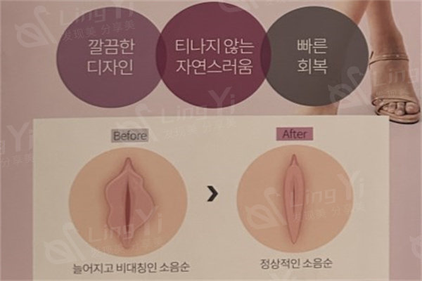 私密修复