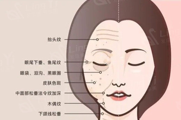 西安拉皮手术医生排名前十