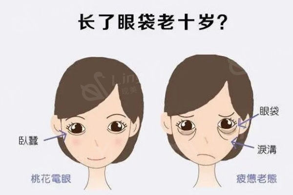 祛眼袋显年轻
