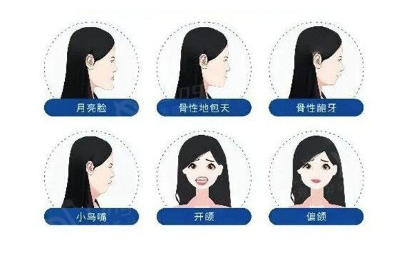 正颌骨手术千万别去做?会“长瘤”这句话你信了吗?