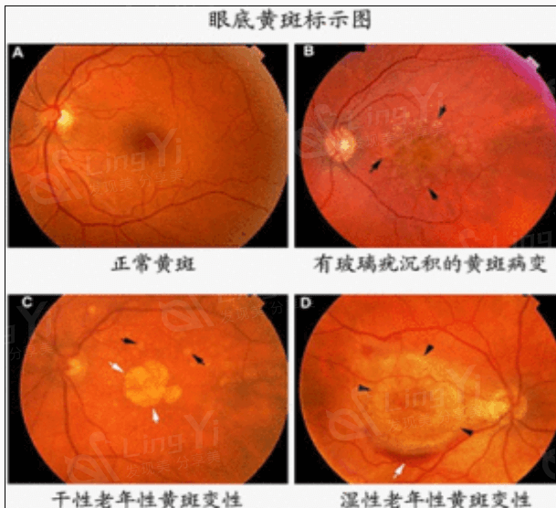 深圳新视代眼科医院是不是正规的 正规眼科医院手术收费合理靠谱 