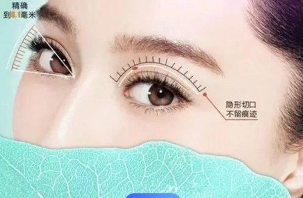 成都双眼皮失败修复医院排名