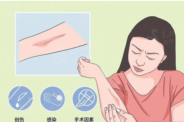 长春整形医院收费标准公开:注射除皱去鱼尾纹|热提拉|自体脂肪填泪沟|去鼻唇沟费用公开