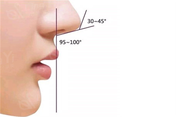 揭秘大连何栋良鼻综合价格表:耳软骨鼻综合6W+肋软骨鼻综合8W+