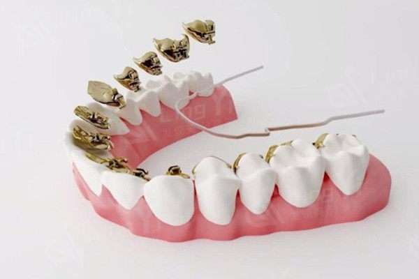 吉林市口腔医院收费标准，种植牙/牙齿矫正/补牙/拔牙价格不贵