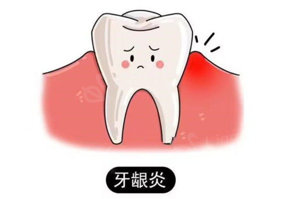 重庆市牙科医院收费标准新版：镶牙860+种植牙2870+矫正5500元起