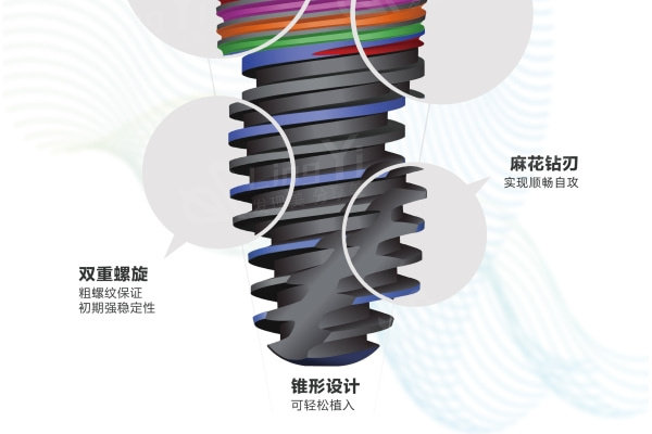 2024国内十大种植牙集采品牌有哪些