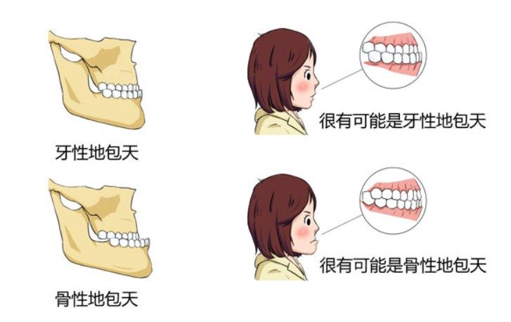 广州正颌手术费用一般是多少钱?4W起还有资质可靠的正颌医院推荐