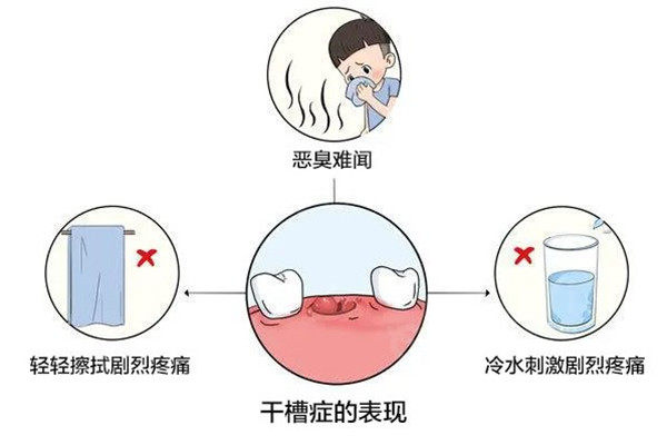 上海新菲英博口腔收费价目表：进口植体2262/全瓷牙1482元起附方式