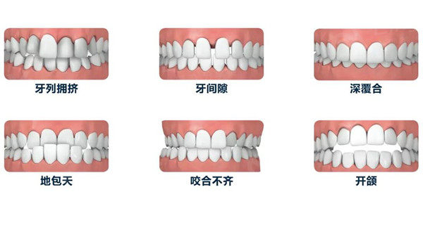 全新昆明松鼠口腔医院价目表:查询种牙/矫正多少钱拔牙|补牙怎么收费