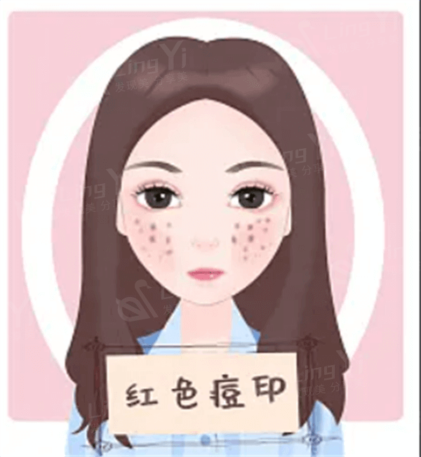 无锡丽都整形医院怎么样？ 正规靠谱医院不坑人