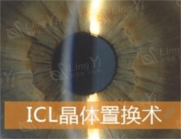 郑州青光眼哪个眼科医院好？ 这些均是正规的眼科医院价格不贵