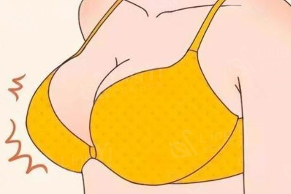 深圳南雅医疗美容做胸怎么样?