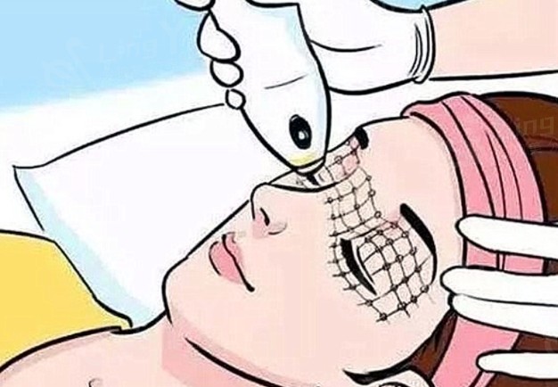 昆明做热玛吉哪家好？有官方认证的正规皮肤科可以看看这几家