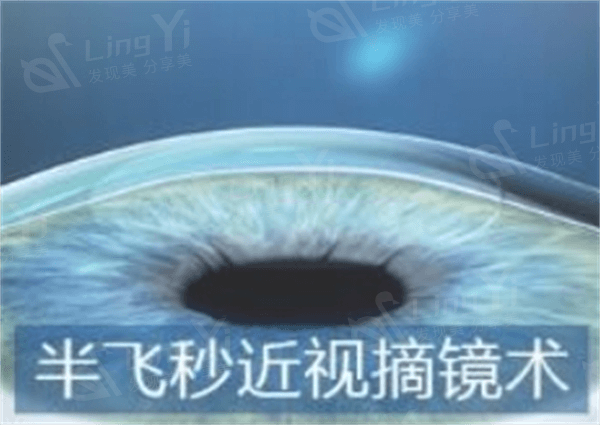 武汉青光眼哪家正规好一点？ 这些医院做青光眼都不错！