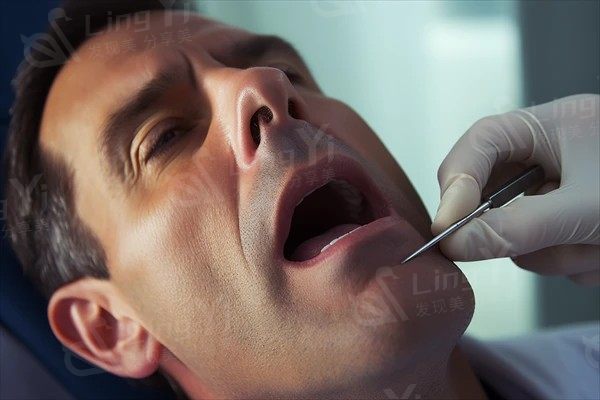 做显微根管治疗后，可以吃零食吗？专家告诉你注意事项与建议！