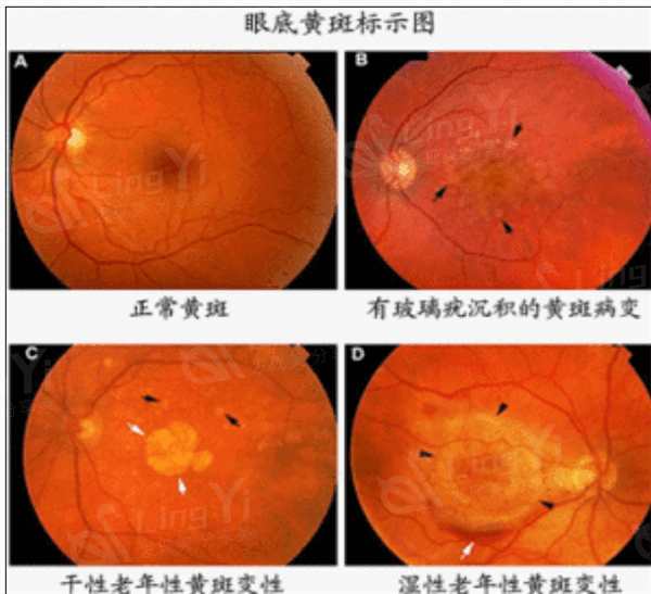 昆明准分子激光好的眼科医院排名 汇总昆明准分子激光便宜又好的医院医生