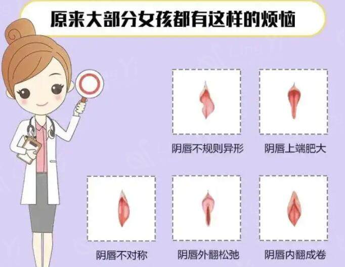 阴唇2.jpg
