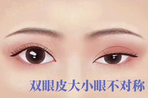 佀同帅修复眼睛好不好?对比技术实力/手术风格/收费标准值得放心