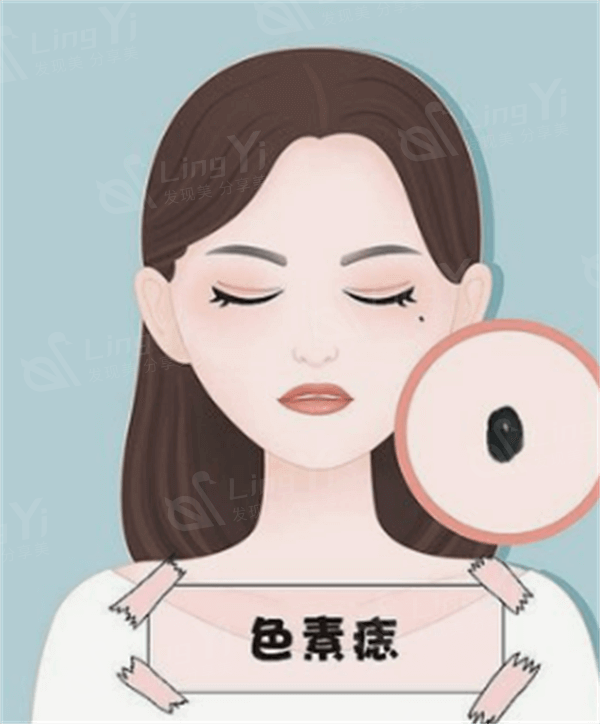广东佛山美莱整形 他家正规且性价比高