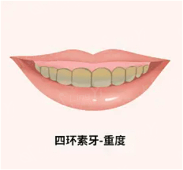 大连M唇手术哪个整形医院可以做 排名靠前的维恩